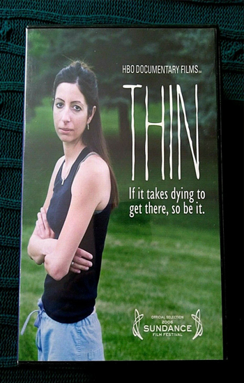 Anoreksiya Nervoza - Yeme Bozukluğu